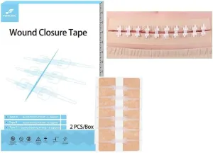 Emergency Wound Closure Tape | Butterfly Bandages for Wound Repair | Laceration Closure Strips (6 Zipper/PC) | Stitch-Free Skin Glue Alternative | 2.4”x4.1” Steri Strips for 0-9cm Cuts
